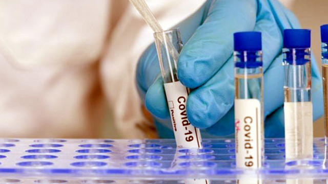 3475 са новите случаи на COVID-19 у нас, излекуваните са 2435