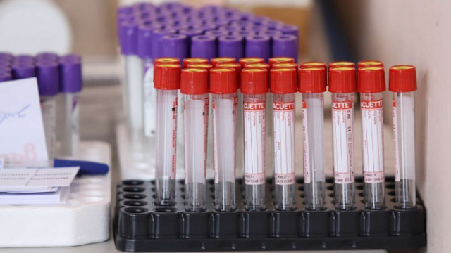 Над 1,5 милиона жертви на COVID-19 в света