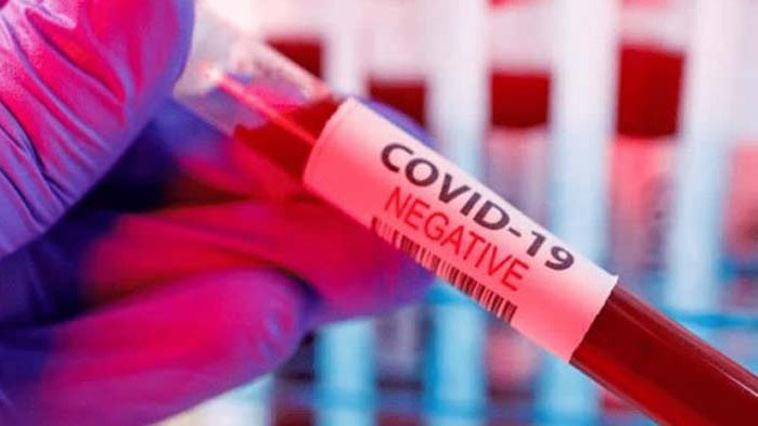 Леко повишение: 3614 са новите случаи на COVID-19 у нас за последното денонощие