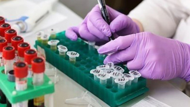 659 новозаразени с COVID-19 в Северна Македония