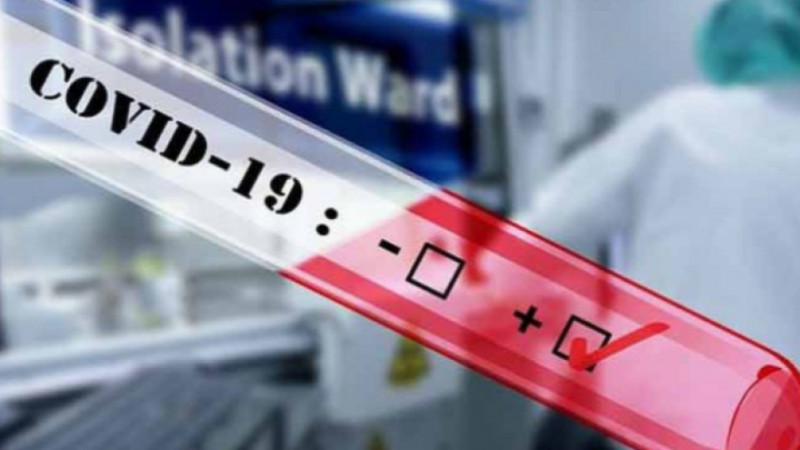 662 са новите случаи на COVID-19 за последните три денонощия във Варна