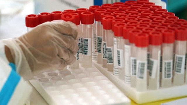 3328 нови случая на COVID-19 у нас за последното денонощие