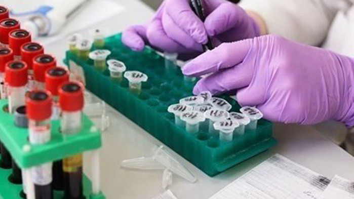 1849 новозаразени с COVID-19 в Словения