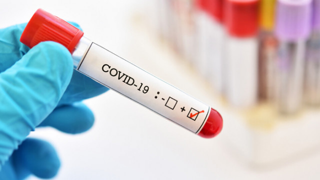 137 нови случая на COVID-19 в област Русе през изминалите 24 часа