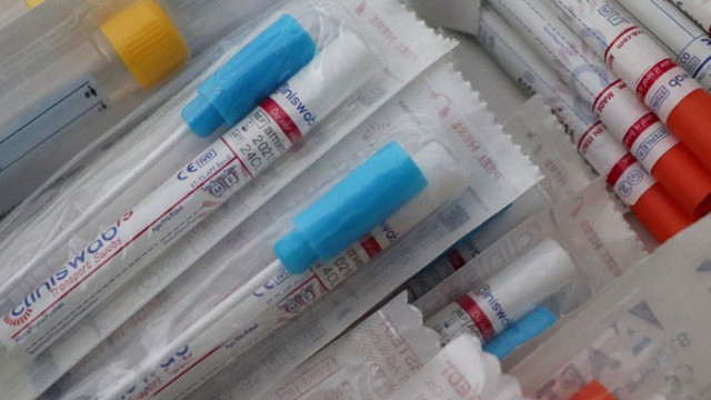 1277 са новите случаи на COVID-19 у нас, 2908 са излекуваните през последното денонощие