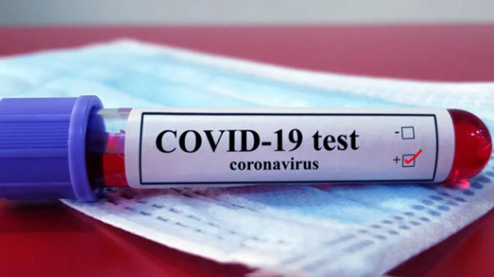 Почти като вчера: 337 са новите случаи на COVID-19 у нас през последното денонощие