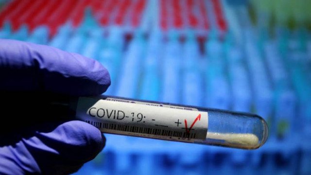 1438 са новите случаи на COVID-19, регистрирани у нас през последното денонощие