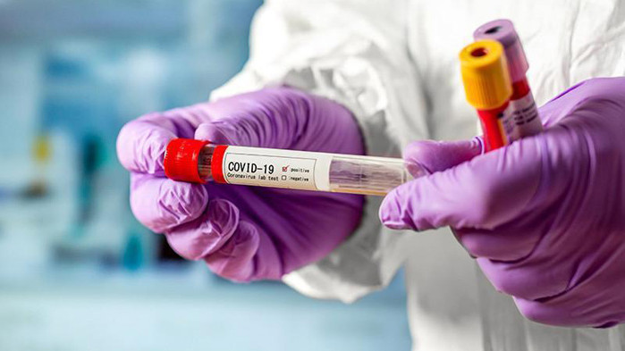 В предпоследния ден на годината 1729 нови случая на COVID-19 у нас