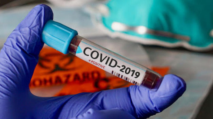 340 са новите случаи на COVID-19 у нас през последното денонощие