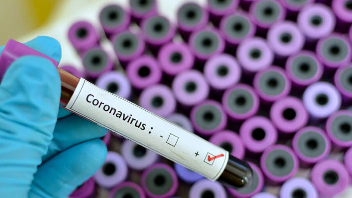 Най-много са починали с COVID в София и Пловдив, най-малко в Кърджали