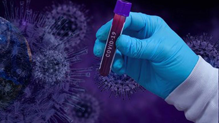 Всяка седмица масово тестване за коронавируса в Словакия