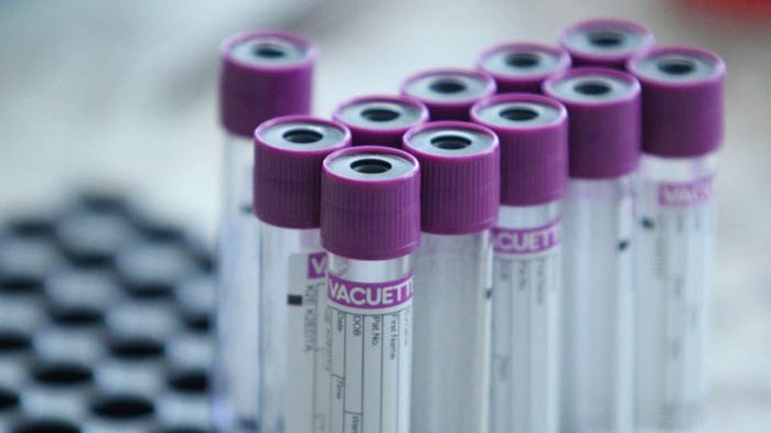 В Доспат: 300 души са под карантина, 95 са заразени