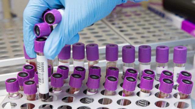 Плавно нагоре: 1115 са новите случаи на COVID-19, установени у нас през последното денонощие