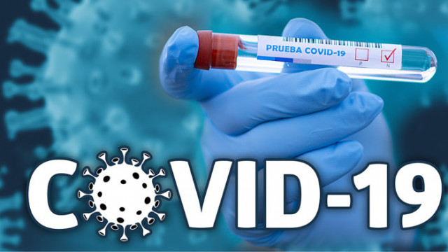 31 са излекуваните във Варна за предното денонощие, активните случаи на COVID-19 са 532