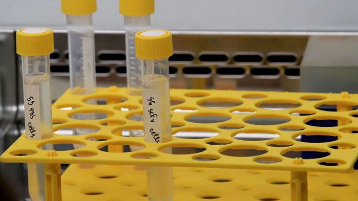 Отпада отрицателният PCR за ученици и студенти от Балканите, пътуващи до България