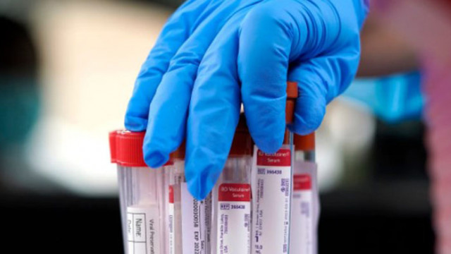 1 349 са новите случаи на COVID-19, установени у нас през последното денонощие