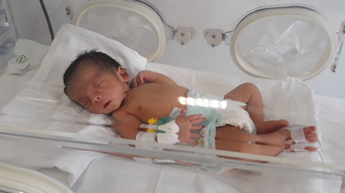 Във Франция жена роди бебе след трансплантация на матка