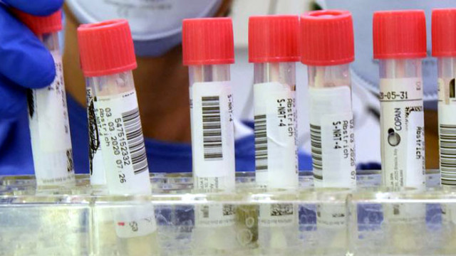 Нагоре: 1925 са новите случаи на COVID-19, установени у нас през последното денонощие