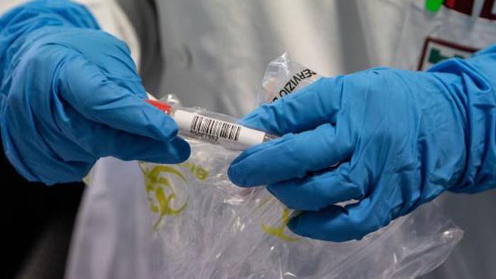 Нов отрицателен рекорд. 112 положителни за коронавирус през последните 24 часа