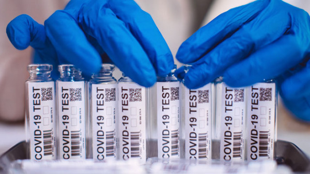 1079 нови случая на COVID-19 са установени у нас в съботния ден