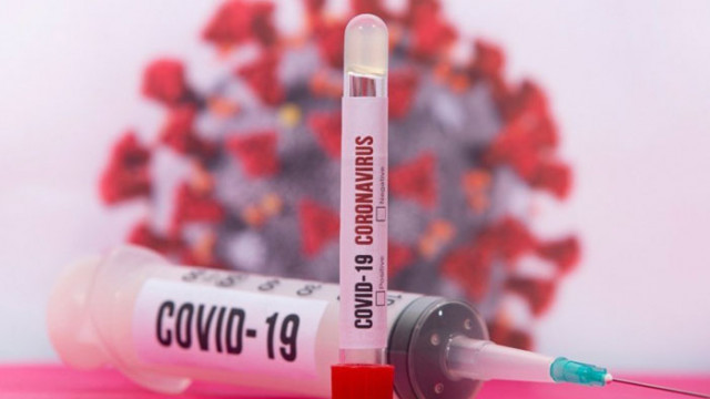 32-годишна бременна жена е сред жертвите на коронавируса у нас