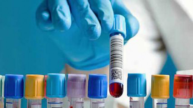 2995 нови случая на COVID-19 за последното денонощие. 150 са починалите