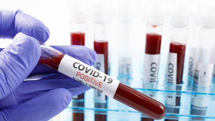 4 374 са новодиагностицираните с COVID-19 лица у нас през