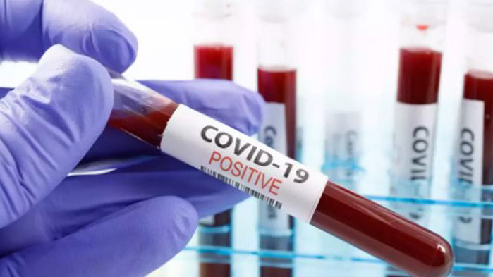 4008 са новите случаи на COVID-19 у нас, регистрирани през последното денонощие