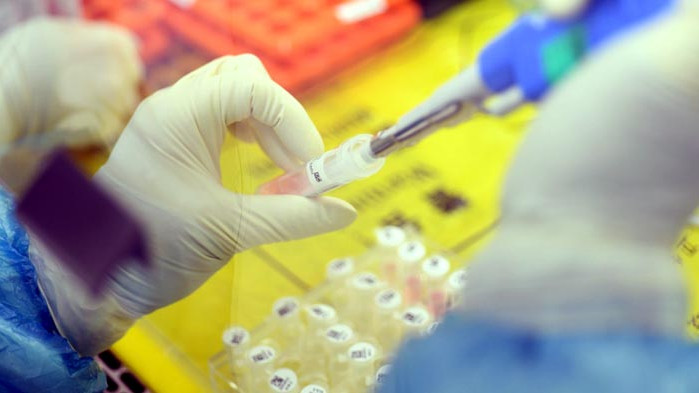 Рекордните 132 нови случая на заразени с коронавирус за последното денонощие