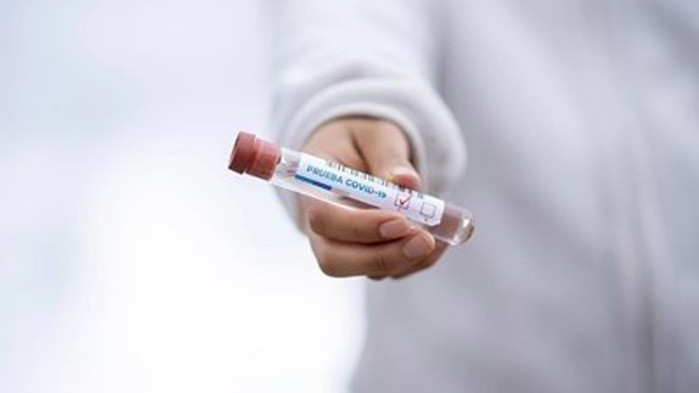 Словения съобщи днес за 1288 новозаразени с коронавирус, което е