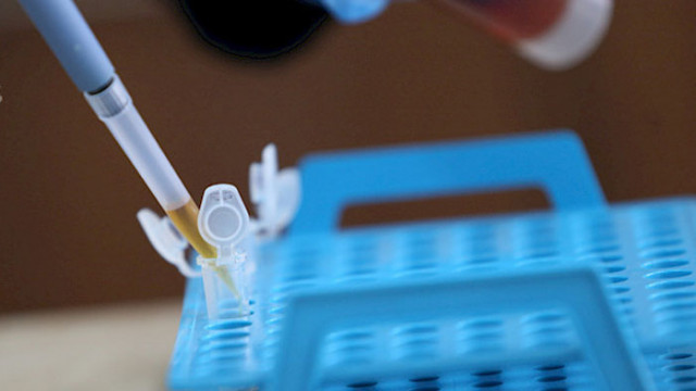 СЗО: 14% ръст на заразените с COVID-19