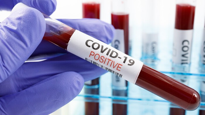 692 заразени COVID- 19 отчита РЗИ-Варна за изминалата седмица, 990 бяха предходната