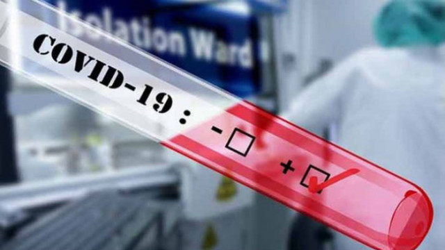 368 със 7 случая повече от вчера са новодиагностицираните с