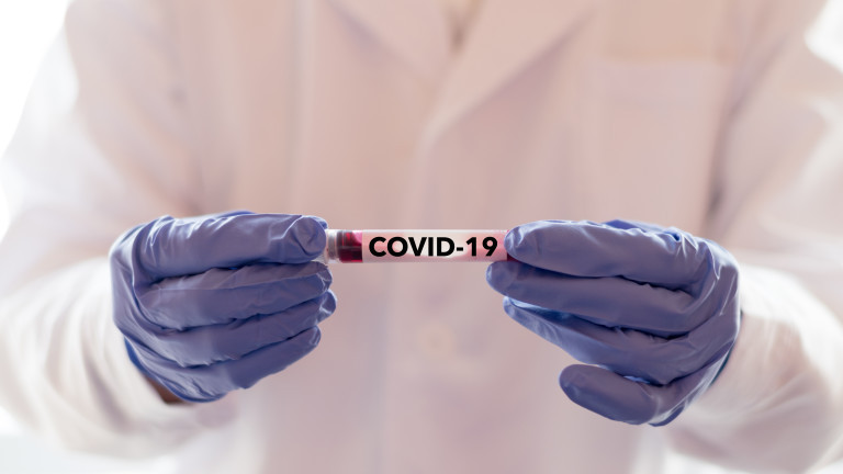 Големи недостатъци в много проучвания за точността на тестовете за антитела за COVID-19