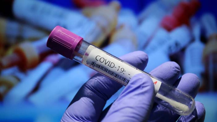 СЗО: Трябват 31 млрд. долара за тестове, ваксини и лечение на COVID-19