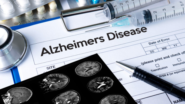 Първото ново лечение за болестта на Алцхаймер от близо 20