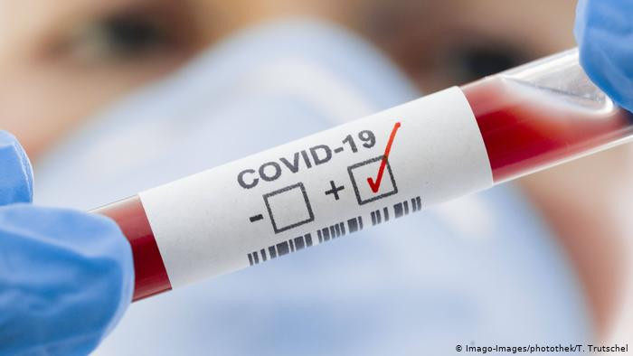 67 са заразените с COVID-19 за седмица във Варна, починали са 15 души