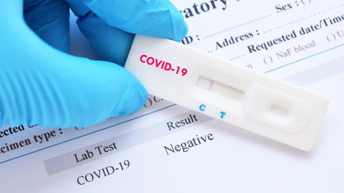 110 са новите заразени с COVID-19 днес. С 15 случая