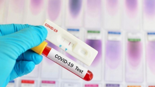 Симптомите на коронавирус са добре известни Кашлицата високата температура хремата