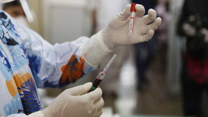През 2021 г. Русия ще произвежда милиони дози ваксина на месец