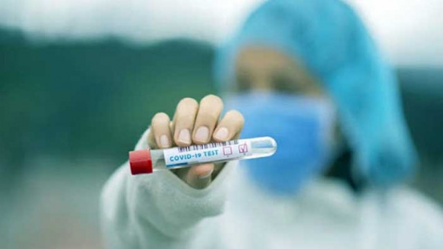 152 са активните случаи на COVID-19 в област Русе