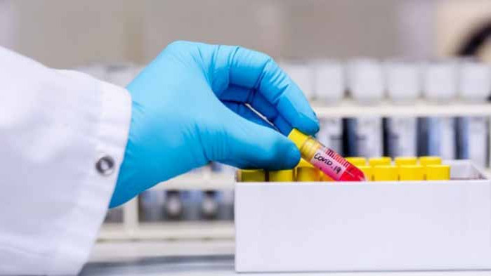 Почти като вчера: 174 нови случая на COVID-19 у нас